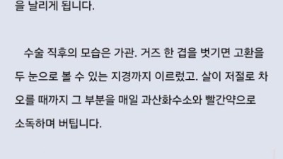 끔찍함주의) 어떤 웹소설 작가에게 생긴 일.jpg